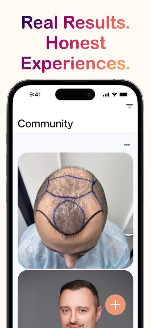 Grafto community stories and patient results